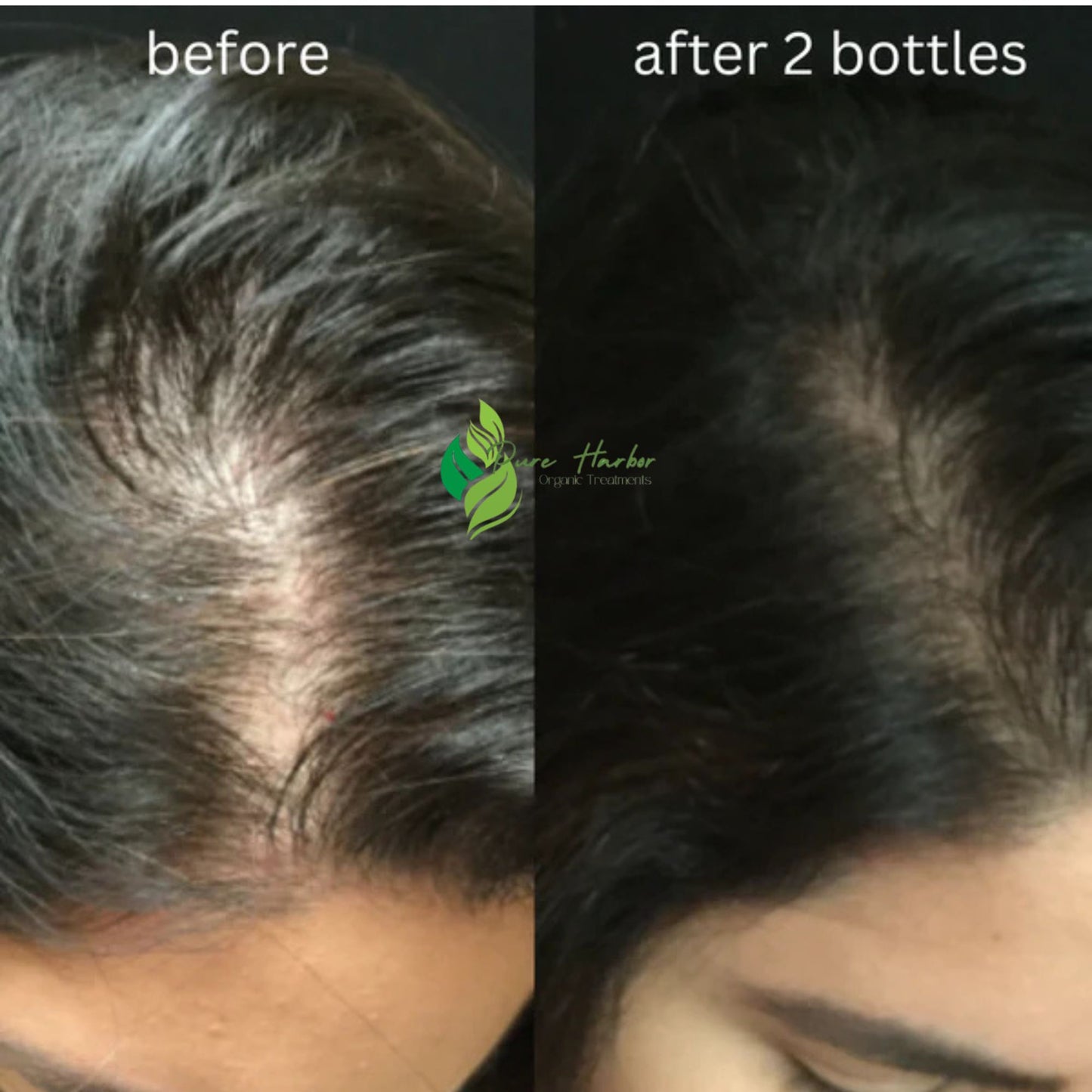 Pure Harbor Hair Oil (100ml) | 40 Days Challenge